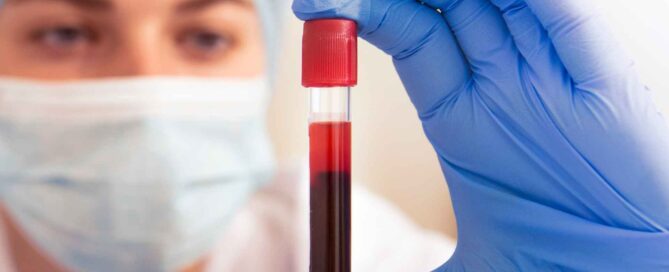 Menopause Hormone Blood Test